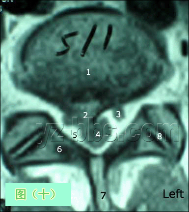 ׵MRI״ͼ